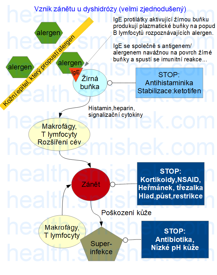 schema zanetu a alergicke reakce ekzem